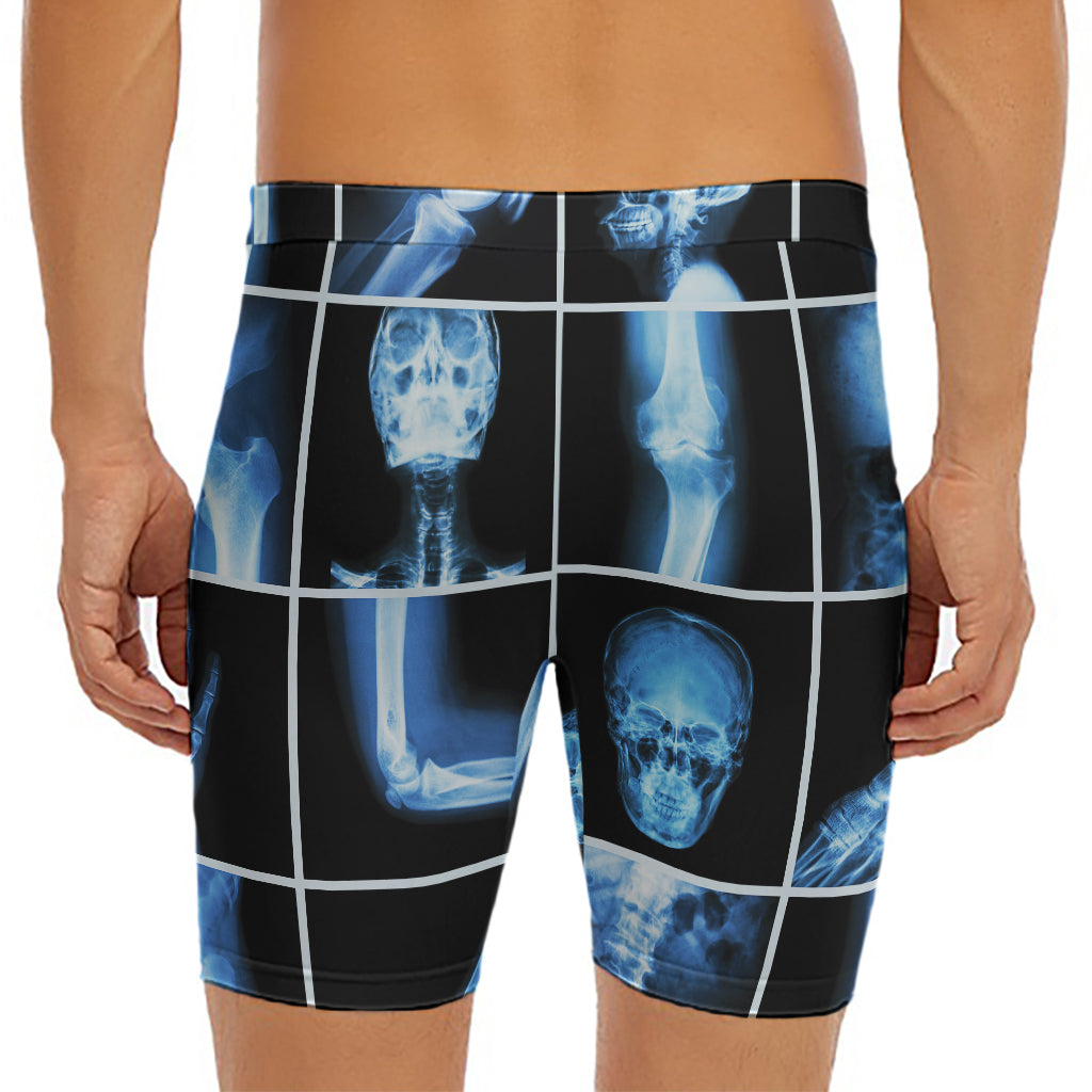 X-Ray Film Radiology Print Men's Long Boxer Briefs