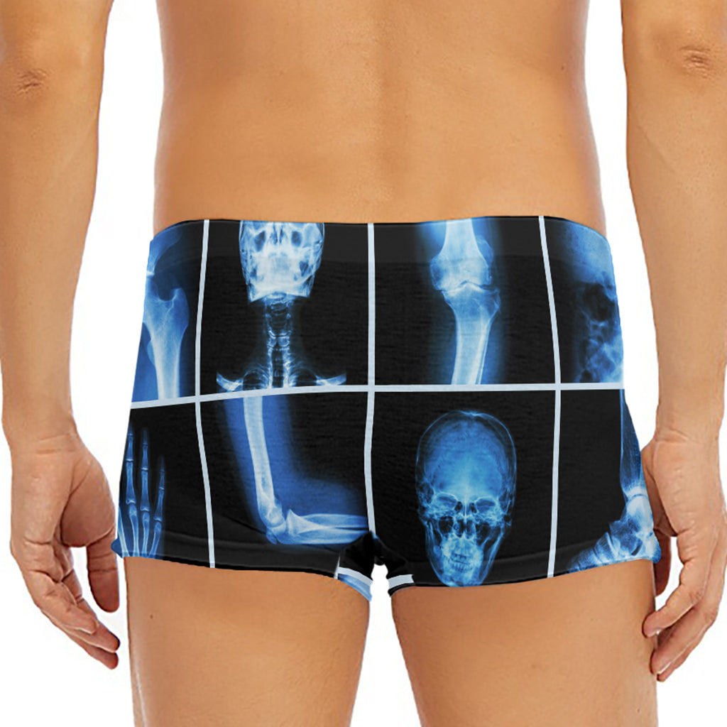 X-Ray Film Radiology Print Men's Short Boxer Briefs