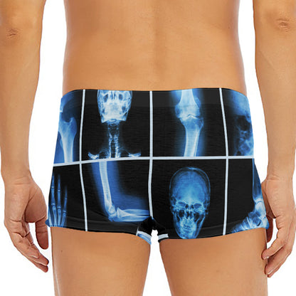 X-Ray Film Radiology Print Men's Short Boxer Briefs
