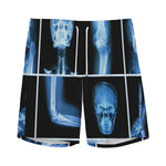 X-Ray Film Radiology Print Men's Sports Shorts