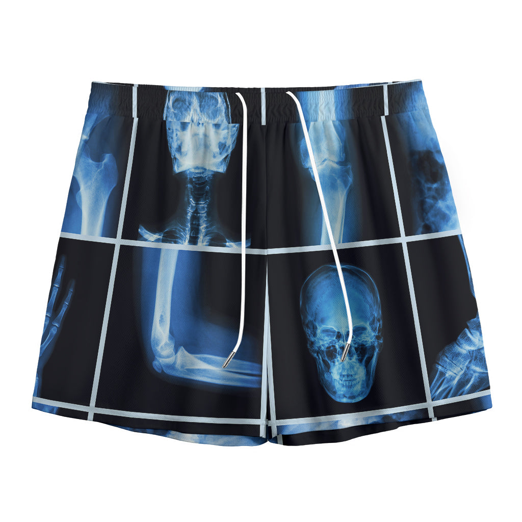 X-Ray Film Radiology Print Mesh Shorts