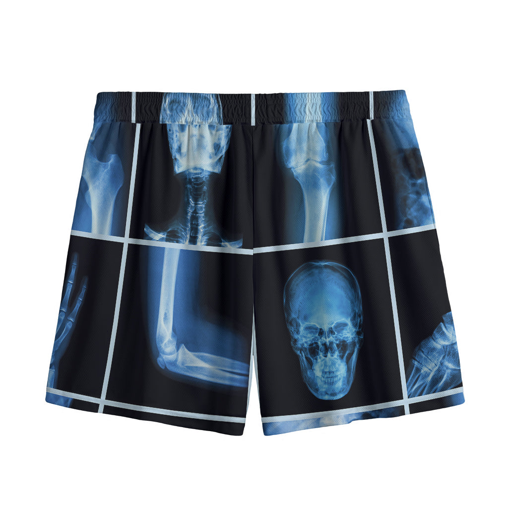 X-Ray Film Radiology Print Mesh Shorts