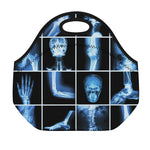 X-Ray Film Radiology Print Neoprene Lunch Bag