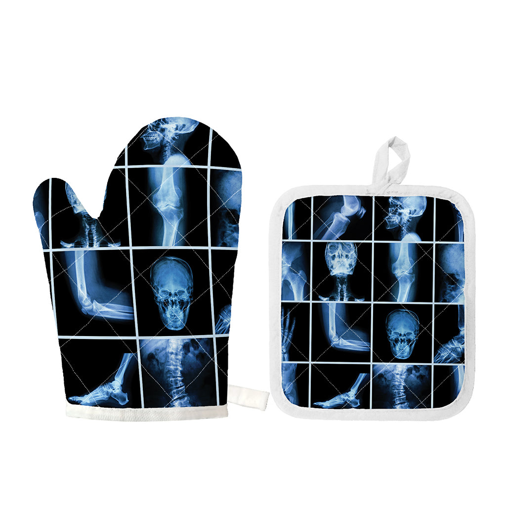 X-Ray Film Radiology Print Oven Mitt And Pot Holder Set