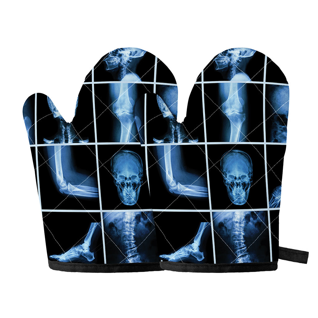 X-Ray Film Radiology Print Oven Mitts