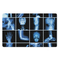 X-Ray Film Radiology Print Polyester Doormat
