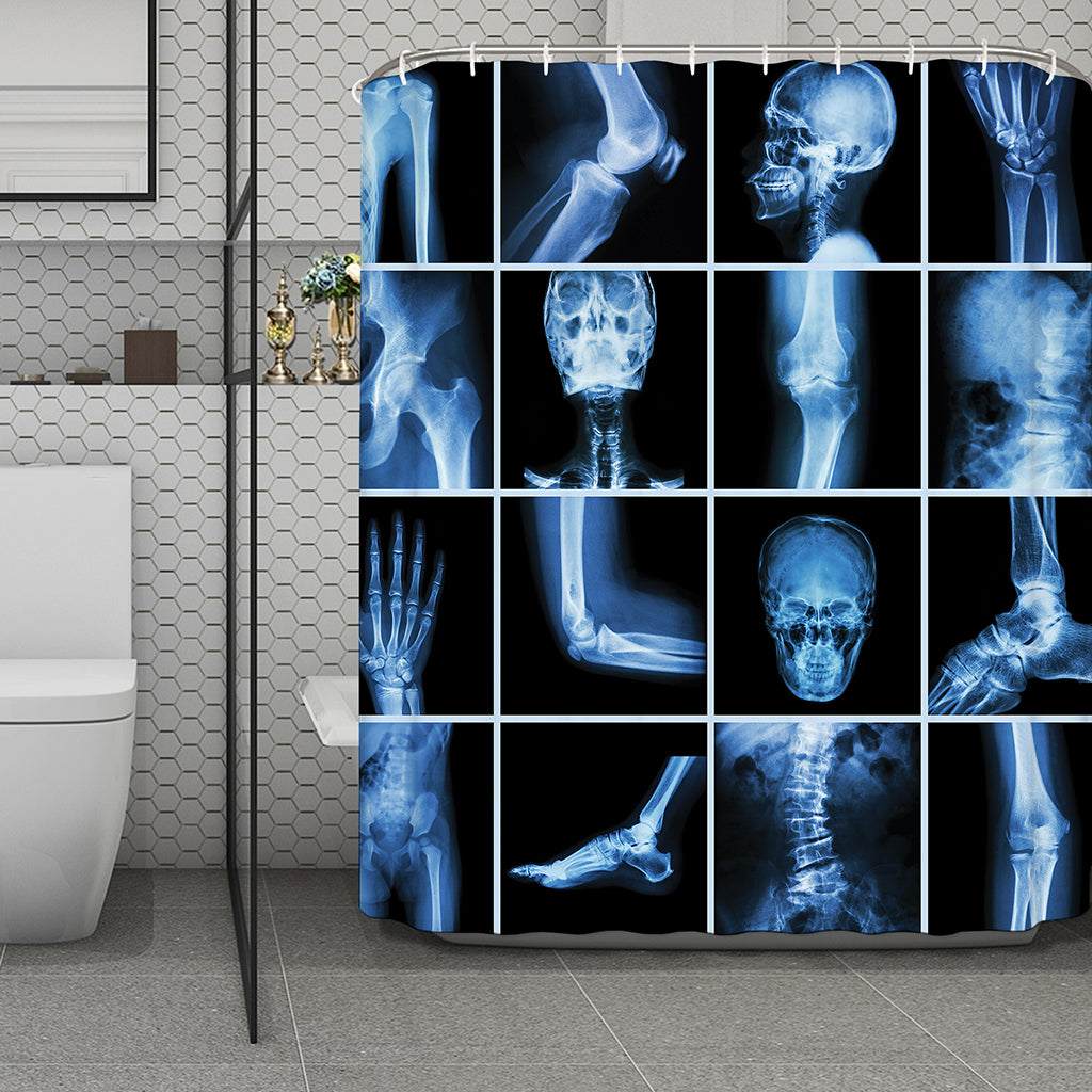 X-Ray Film Radiology Print Polyester Shower Curtain