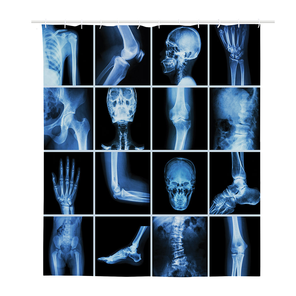 X-Ray Film Radiology Print Polyester Shower Curtain