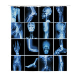 X-Ray Film Radiology Print Polyester Shower Curtain