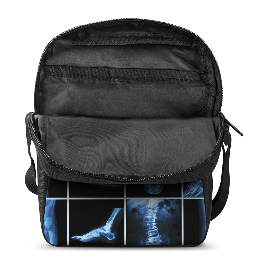 X-Ray Film Radiology Print Rectangular Crossbody Bag