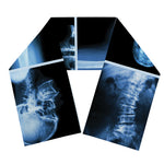 X-Ray Film Radiology Print Scarf