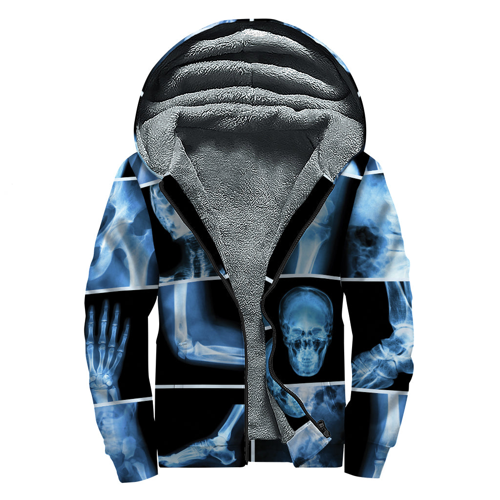 X-Ray Film Radiology Print Sherpa Lined Zip Up Hoodie