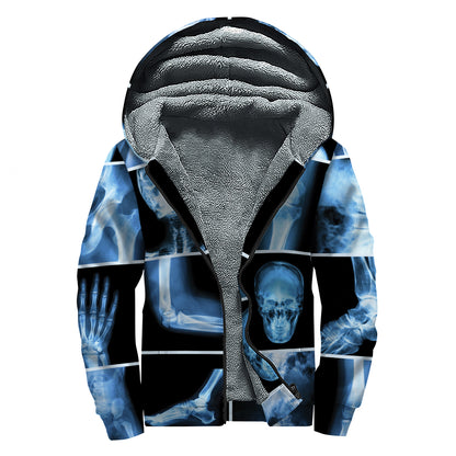 X-Ray Film Radiology Print Sherpa Lined Zip Up Hoodie