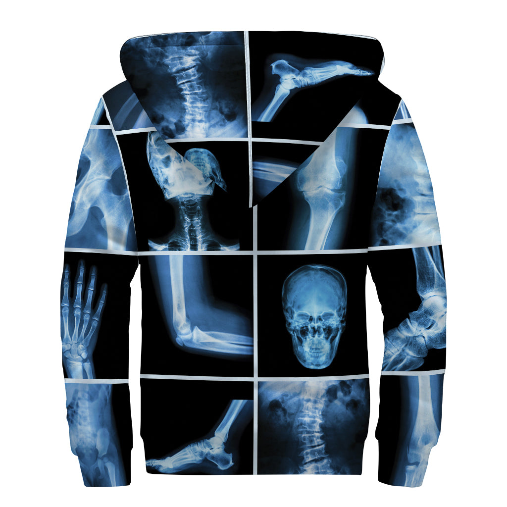 X-Ray Film Radiology Print Sherpa Lined Zip Up Hoodie