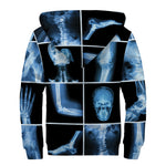 X-Ray Film Radiology Print Sherpa Lined Zip Up Hoodie