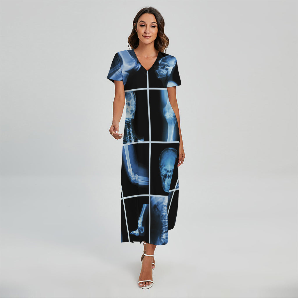 X-Ray Film Radiology Print Short Sleeve Maxi Dress