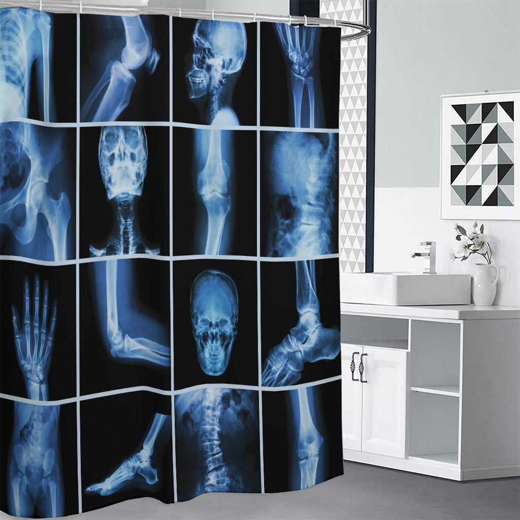 X-Ray Film Radiology Print Shower Curtain