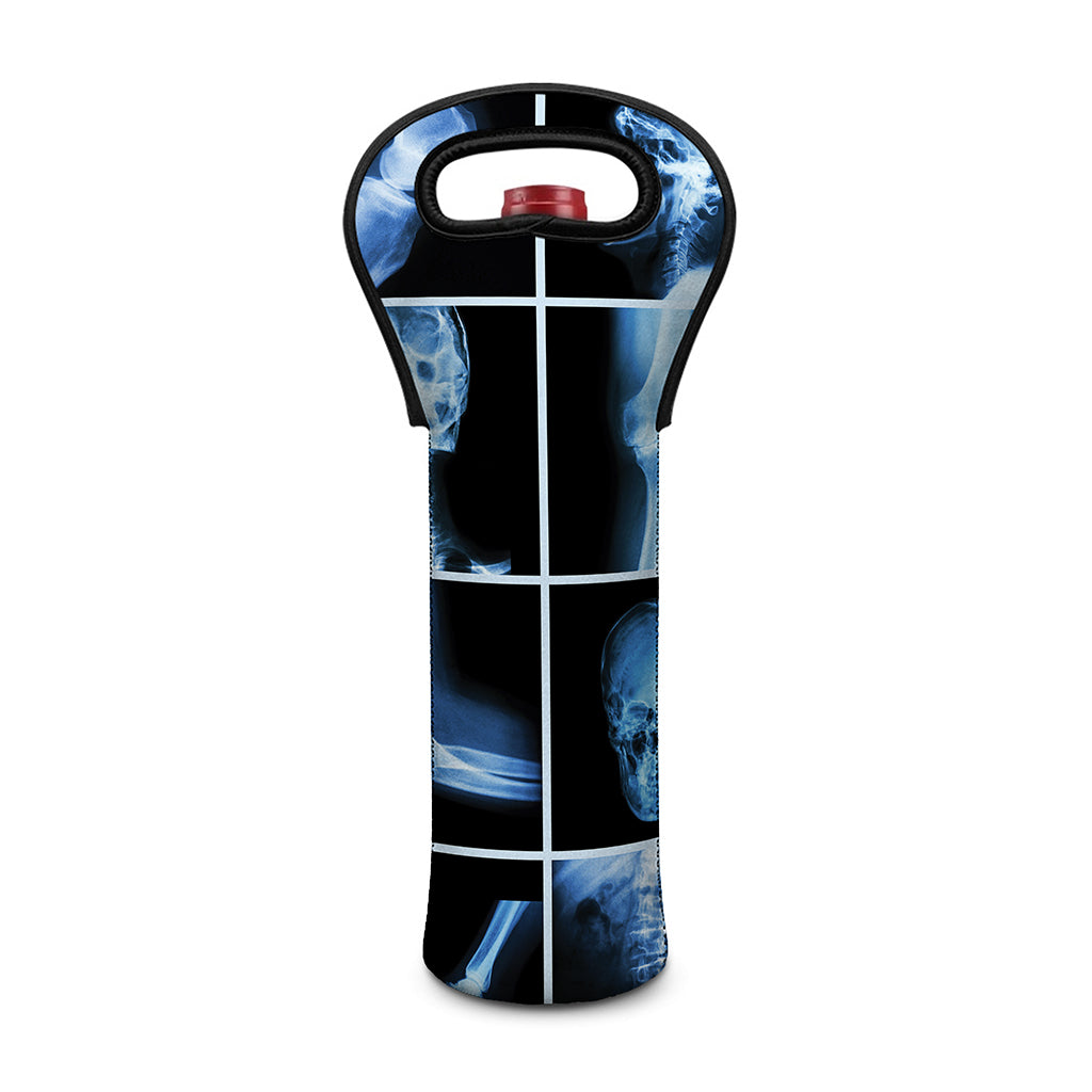 X-Ray Film Radiology Print Single Neoprene Wine Tote