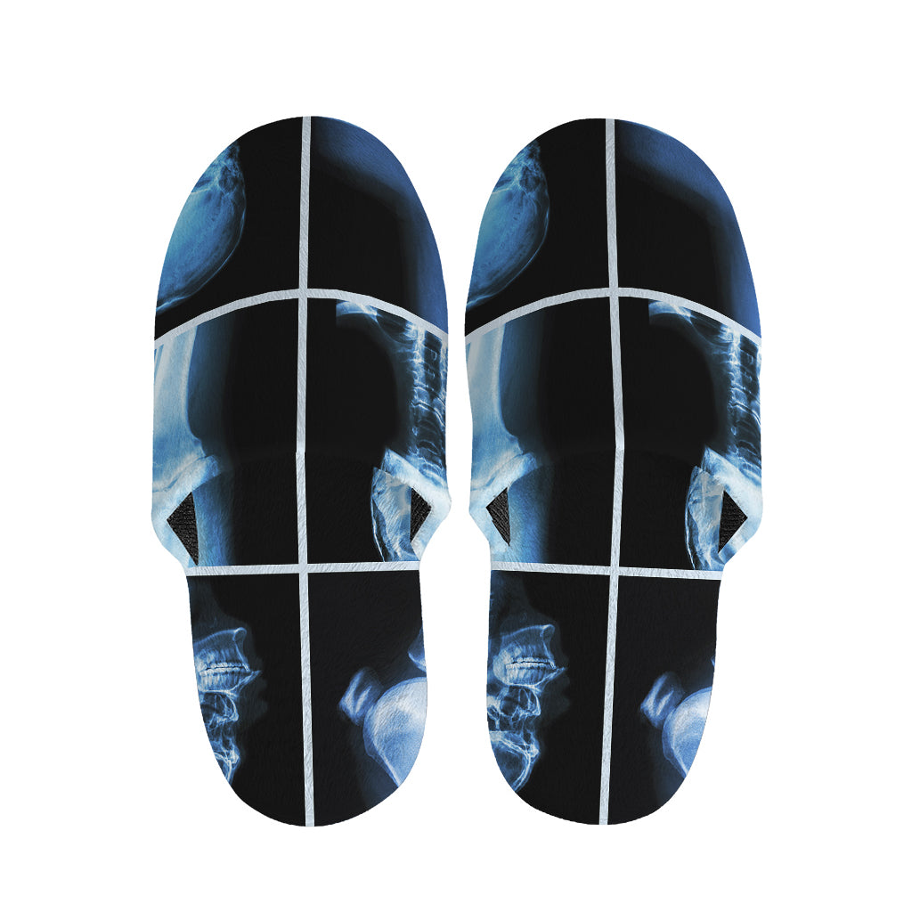 X-Ray Film Radiology Print Slippers