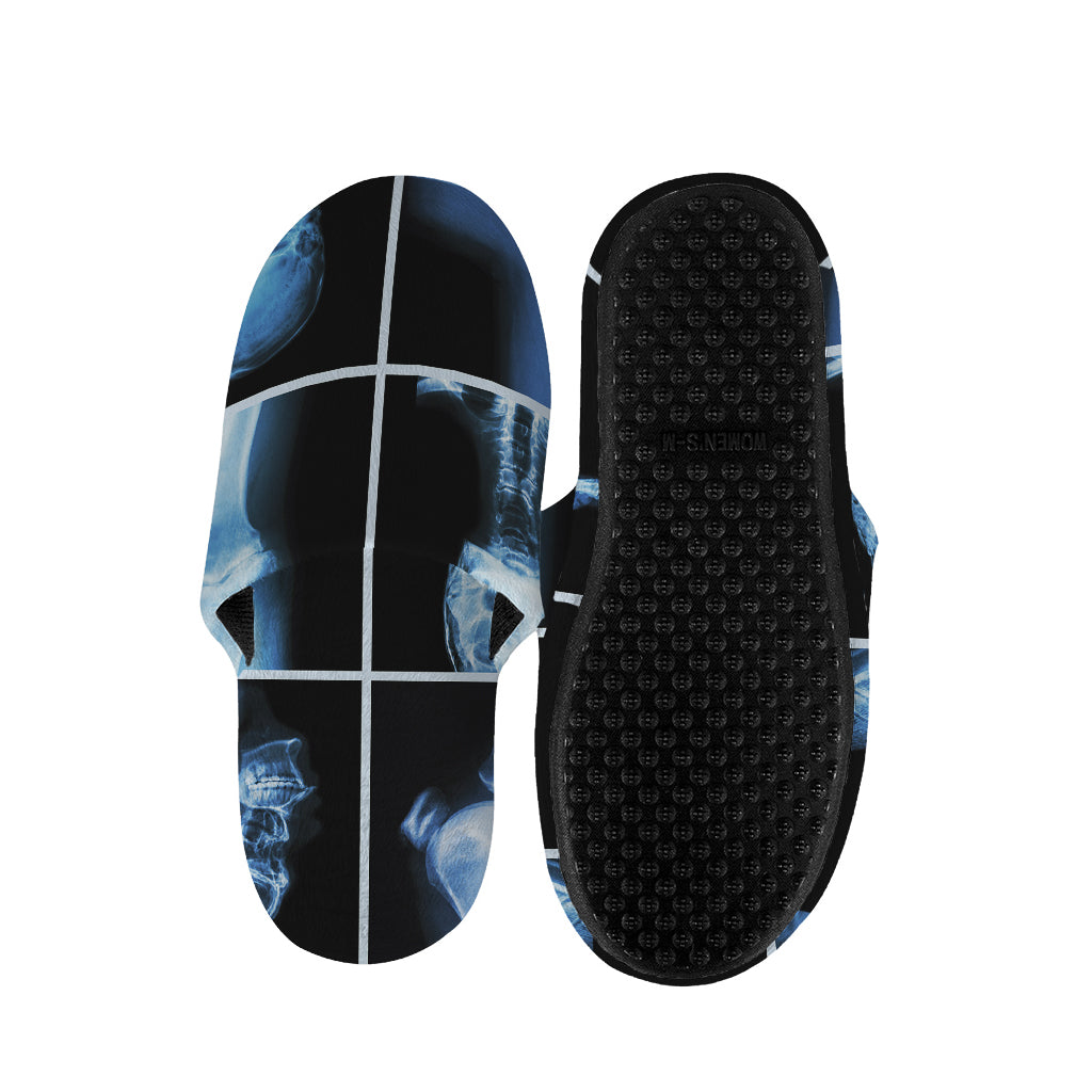 X-Ray Film Radiology Print Slippers