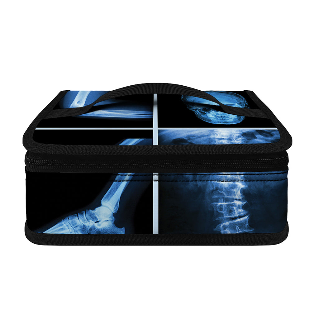 X-Ray Film Radiology Print Small Lunch Bag