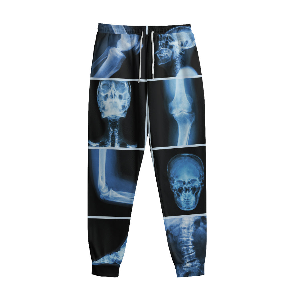 X-Ray Film Radiology Print Sweatpants