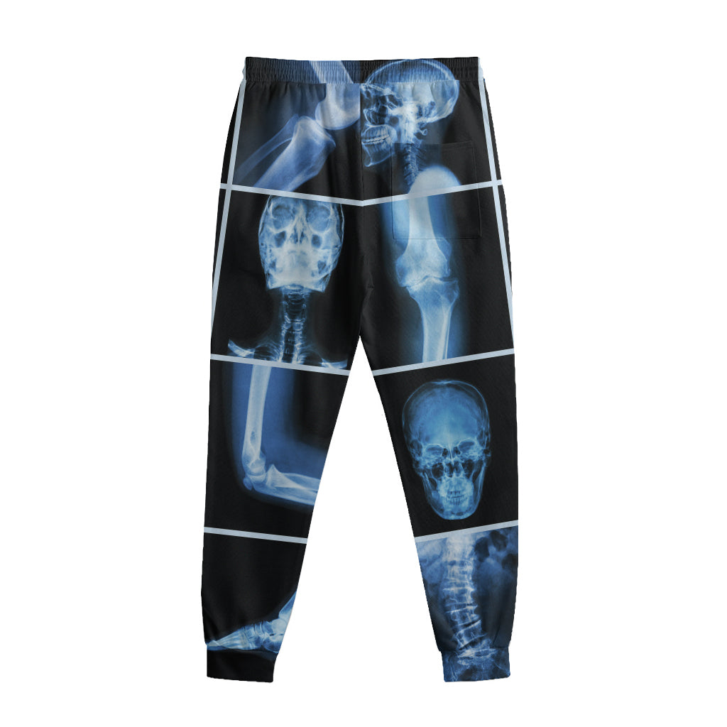 X-Ray Film Radiology Print Sweatpants