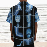 X-Ray Film Radiology Print Textured Short Sleeve Shirt