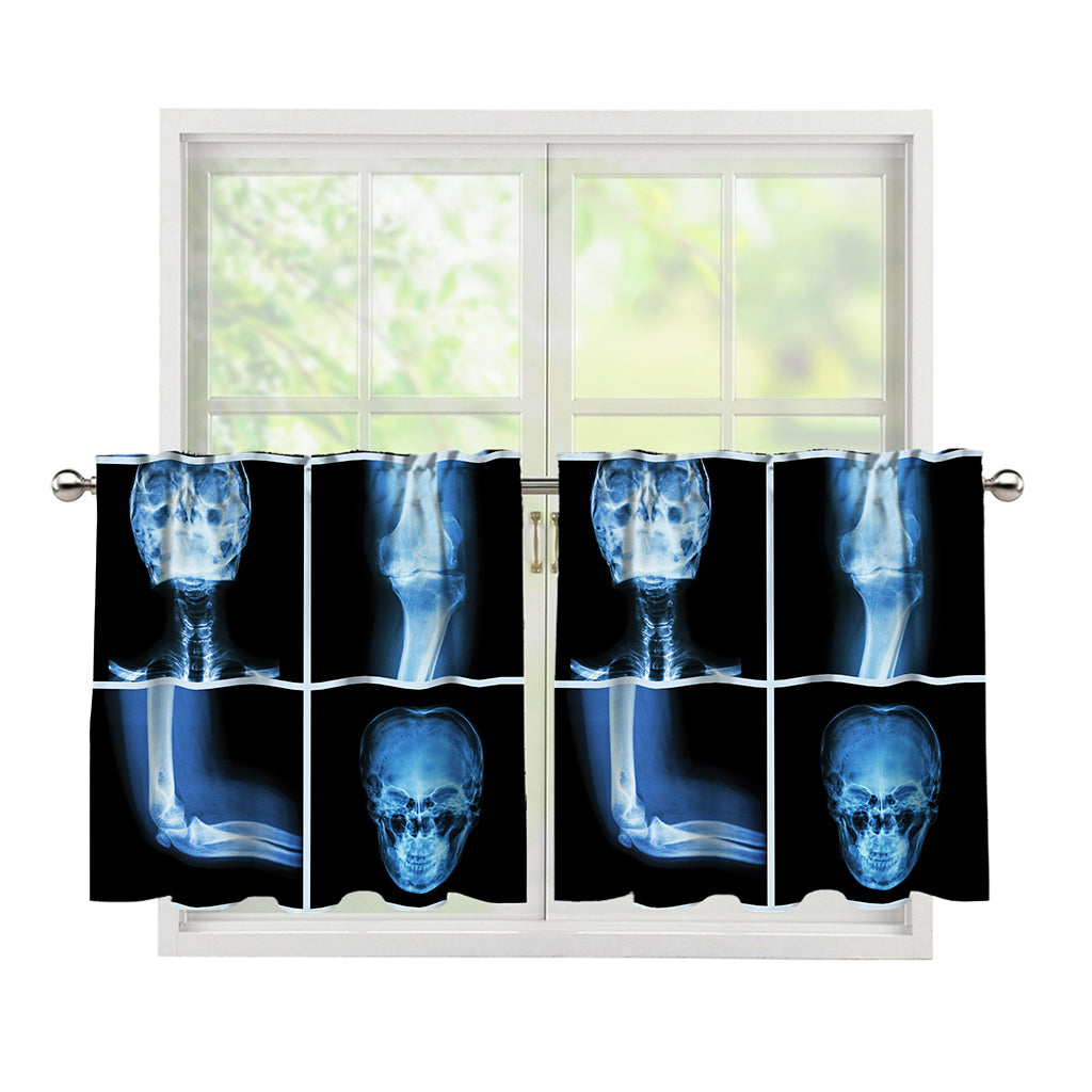 X-Ray Film Radiology Print Tier Curtains