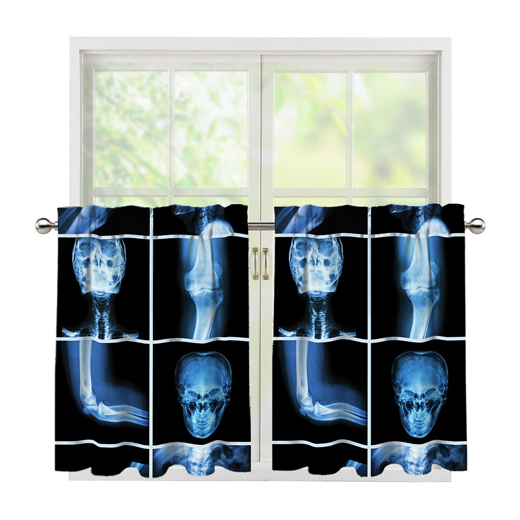 X-Ray Film Radiology Print Tier Curtains