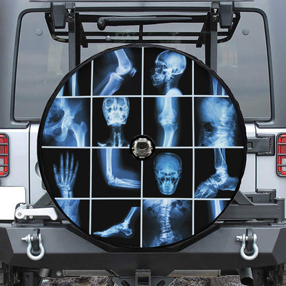 X-Ray Film Radiology Print Tire Cover With Camera Hole