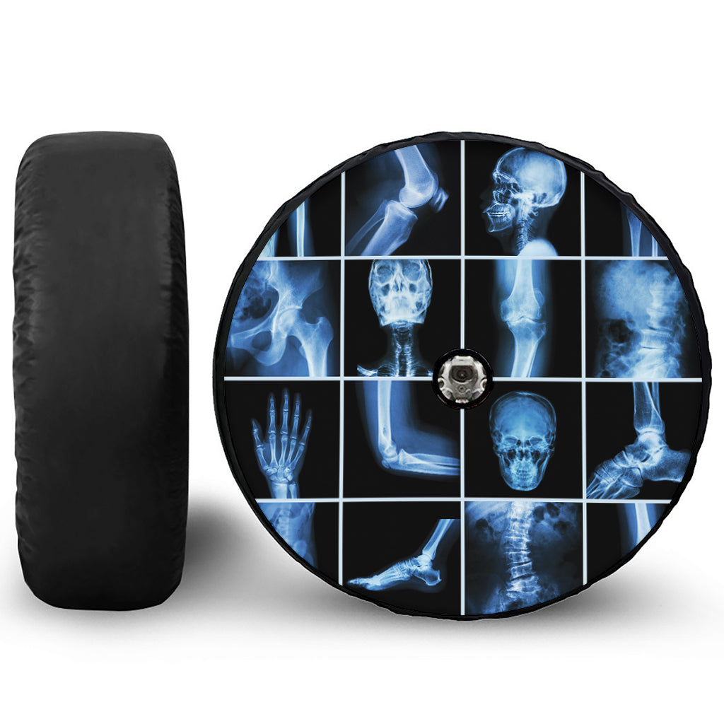 X-Ray Film Radiology Print Tire Cover With Camera Hole