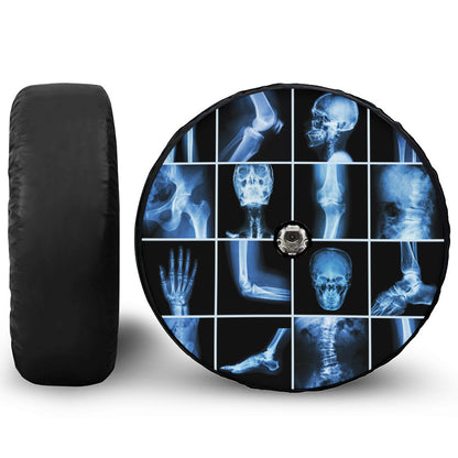 X-Ray Film Radiology Print Tire Cover With Camera Hole