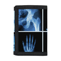 X-Ray Film Radiology Print Trifold Wallet