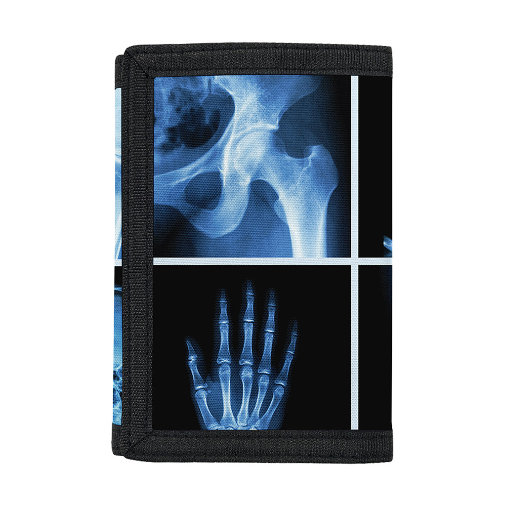 X-Ray Film Radiology Print Trifold Wallet