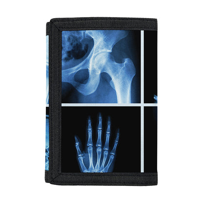 X-Ray Film Radiology Print Trifold Wallet