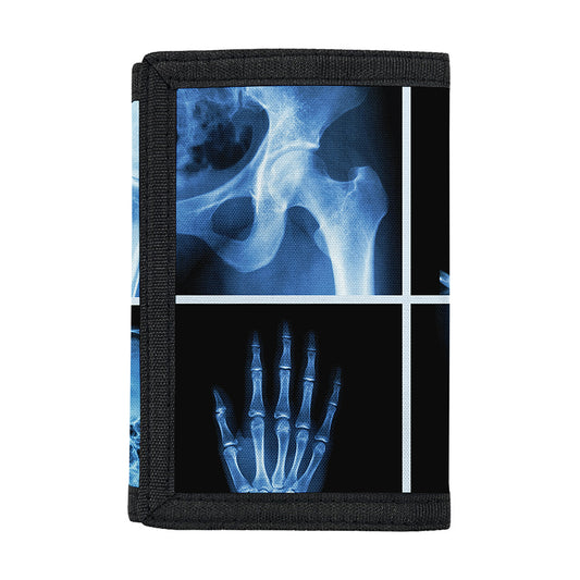X-Ray Film Radiology Print Trifold Wallet
