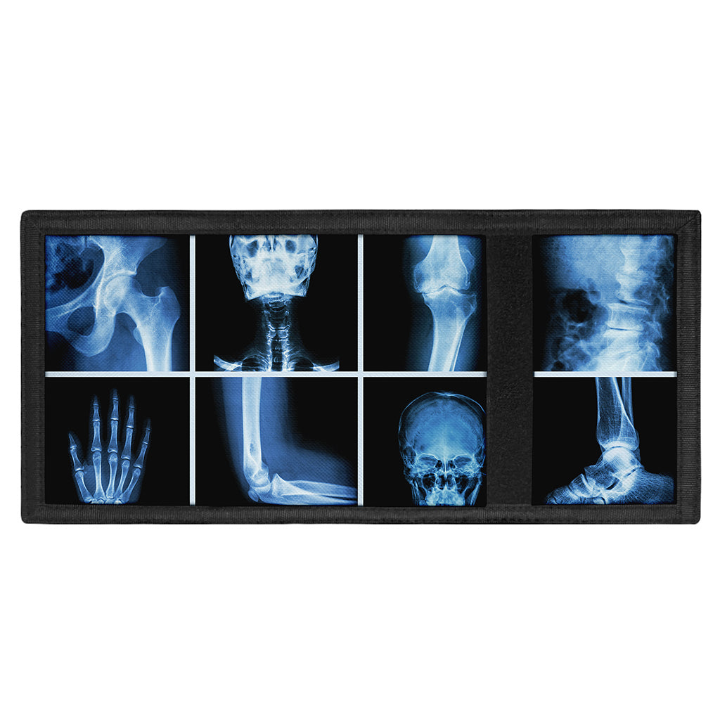 X-Ray Film Radiology Print Trifold Wallet