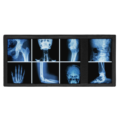X-Ray Film Radiology Print Trifold Wallet