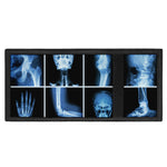 X-Ray Film Radiology Print Trifold Wallet