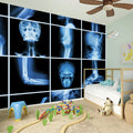 X-Ray Film Radiology Print Wall Sticker