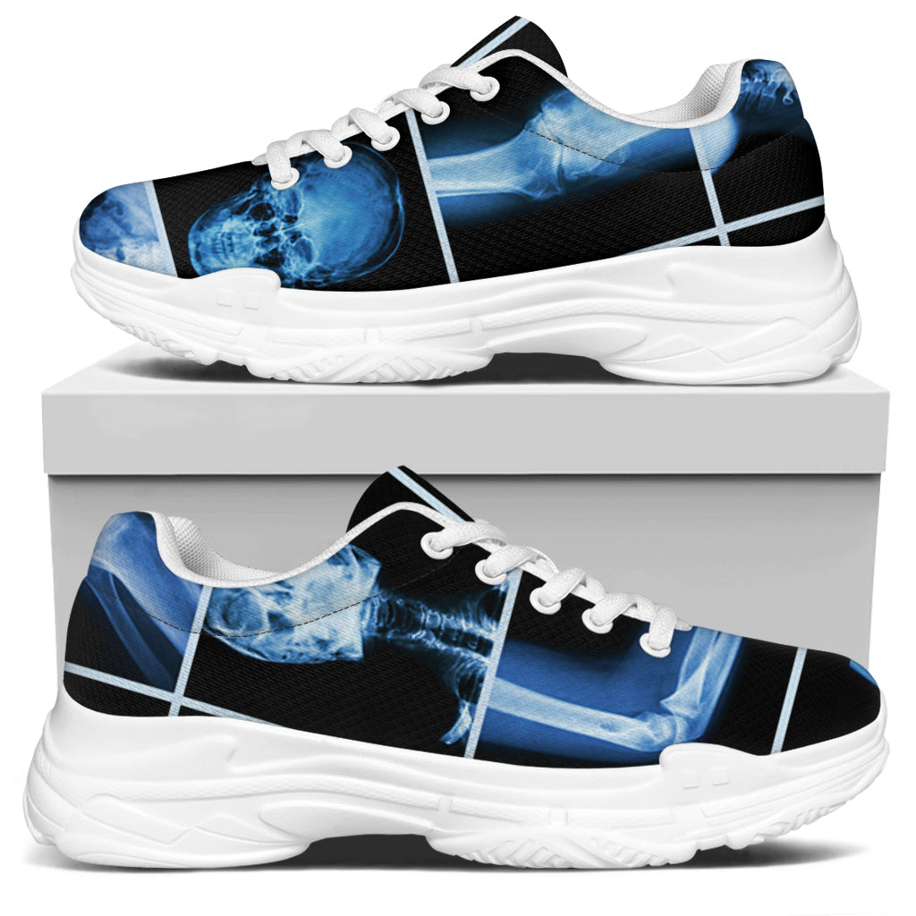 X-Ray Film Radiology Print White Chunky Shoes