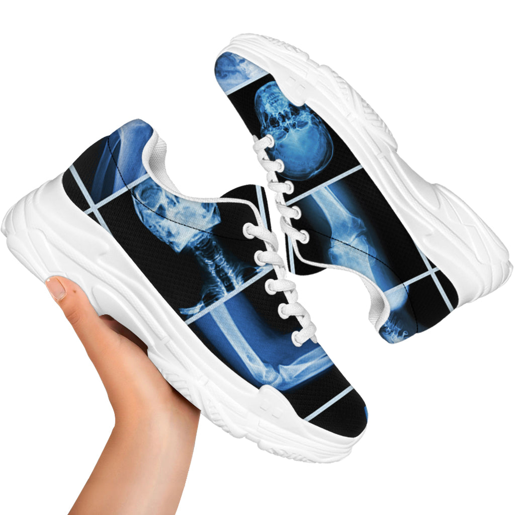 X-Ray Film Radiology Print White Chunky Shoes