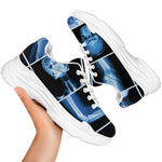 X-Ray Film Radiology Print White Chunky Shoes