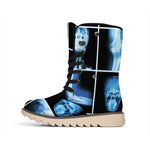 X-Ray Film Radiology Print Winter Boots