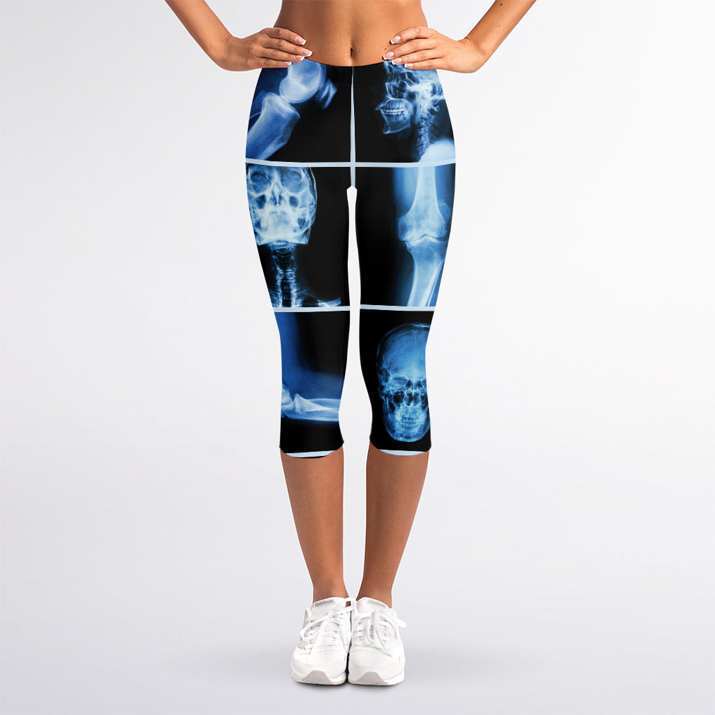 X-Ray Film Radiology Print Women's Capri Leggings