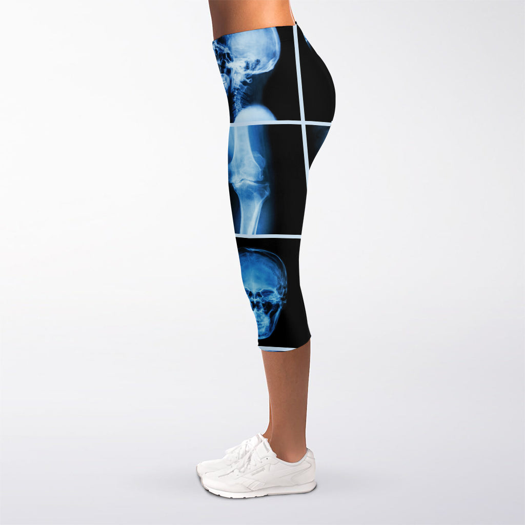 X-Ray Film Radiology Print Women's Capri Leggings