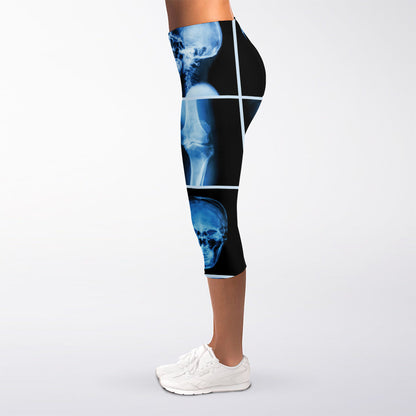 X-Ray Film Radiology Print Women's Capri Leggings