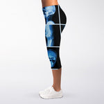 X-Ray Film Radiology Print Women's Capri Leggings