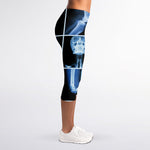 X-Ray Film Radiology Print Women's Capri Leggings